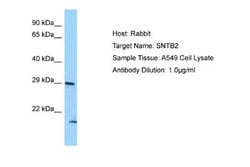SNTB2 Antibody, Novus Biologicals 100 &mu;L | Buy Online | Novus Biologicals | Fisher Scientific